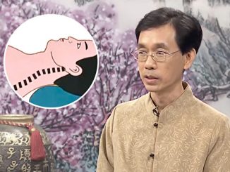 落枕治疗