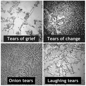 显微镜下的眼泪