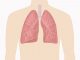 肺功能 检测 肺病